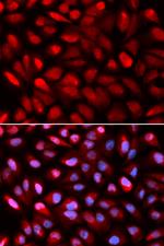 PCBP2 Antibody in Immunocytochemistry (ICC/IF)