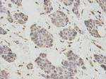 PCBP2 Antibody in Immunohistochemistry (Paraffin) (IHC (P))