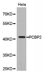 PCBP2 Antibody in Western Blot (WB)