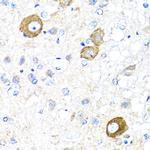 NRG4 Antibody in Immunohistochemistry (Paraffin) (IHC (P))