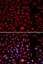 AXIN2 Antibody in Immunocytochemistry (ICC/IF)