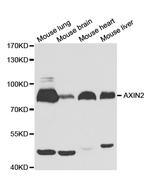 AXIN2 Antibody in Western Blot (WB)