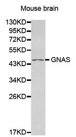 GNAS Antibody in Western Blot (WB)