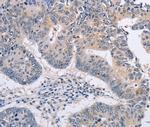 FBXO32 Antibody in Immunohistochemistry (Paraffin) (IHC (P))