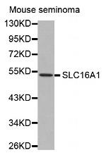 MCT1 Antibody in Western Blot (WB)