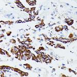 MMP25 Antibody in Immunohistochemistry (Paraffin) (IHC (P))