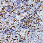 MMP25 Antibody in Immunohistochemistry (Paraffin) (IHC (P))