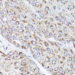 RAMP2 Antibody in Immunohistochemistry (Paraffin) (IHC (P))