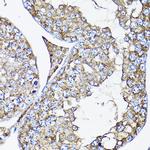 RAMP2 Antibody in Immunohistochemistry (Paraffin) (IHC (P))