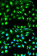 Gemin 2 Antibody in Immunocytochemistry (ICC/IF)