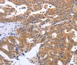 Gemin 2 Antibody in Immunohistochemistry (Paraffin) (IHC (P))