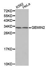 Gemin 2 Antibody in Western Blot (WB)