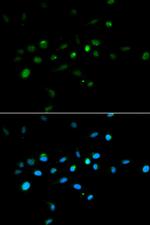 MURF1 Antibody in Immunocytochemistry (ICC/IF)