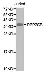 PP2A beta Antibody in Western Blot (WB)