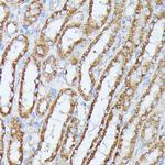 PP2A beta Antibody in Immunohistochemistry (Paraffin) (IHC (P))