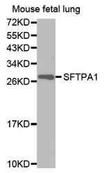 SFTPA1 Antibody in Western Blot (WB)