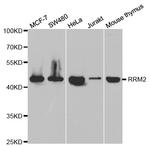 RRM2 Antibody in Western Blot (WB)