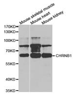 CHRNB1 Antibody in Western Blot (WB)