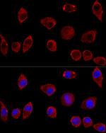 DAO Antibody in Immunocytochemistry (ICC/IF)