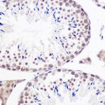 GMNN Antibody in Immunohistochemistry (Paraffin) (IHC (P))