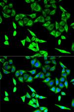 HADHA Antibody in Immunocytochemistry (ICC/IF)