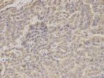 HADHA Antibody in Immunohistochemistry (Paraffin) (IHC (P))