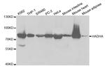 HADHA Antibody in Western Blot (WB)