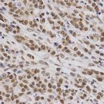 BAF57 Antibody in Immunohistochemistry (Paraffin) (IHC (P))