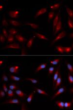 ADAM9 Antibody in Immunocytochemistry (ICC/IF)