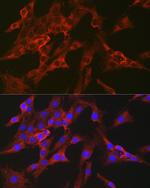 FBP1 Antibody in Immunocytochemistry (ICC/IF)