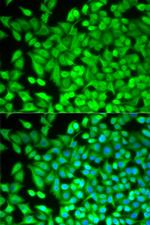 FBP1 Antibody in Immunocytochemistry (ICC/IF)