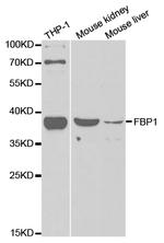 FBP1 Antibody in Western Blot (WB)