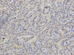 APRT Antibody in Immunohistochemistry (Paraffin) (IHC (P))