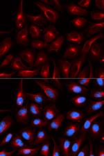 TLE1 Antibody in Immunocytochemistry (ICC/IF)