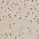 TLE1 Antibody in Immunohistochemistry (Paraffin) (IHC (P))