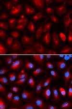 KLC1 Antibody in Immunocytochemistry (ICC/IF)