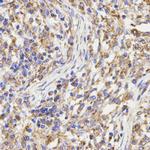 KLC1 Antibody in Immunohistochemistry (Paraffin) (IHC (P))