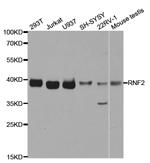 RNF2 Antibody in Western Blot (WB)