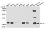 HPRT1 Antibody in Western Blot (WB)