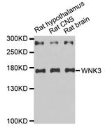 WNK3 Antibody in Western Blot (WB)