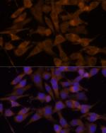 UGT2B7 Antibody in Immunocytochemistry (ICC/IF)