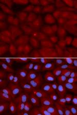 BIN1 Antibody in Immunocytochemistry (ICC/IF)