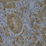 BIN1 Antibody in Immunohistochemistry (Paraffin) (IHC (P))