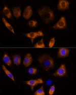 Calpain 3 Antibody in Immunocytochemistry (ICC/IF)