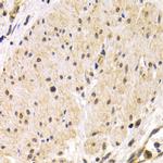 TMPRSS2 Antibody in Immunohistochemistry (Paraffin) (IHC (P))