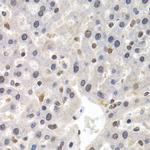 GTF2F1 Antibody in Immunohistochemistry (Paraffin) (IHC (P))