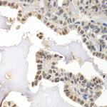 GTF2F1 Antibody in Immunohistochemistry (Paraffin) (IHC (P))