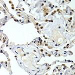 GTF2F1 Antibody in Immunohistochemistry (Paraffin) (IHC (P))