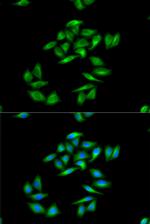 CPT1A Antibody in Immunocytochemistry (ICC/IF)