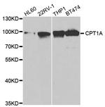 CPT1A Antibody in Western Blot (WB)